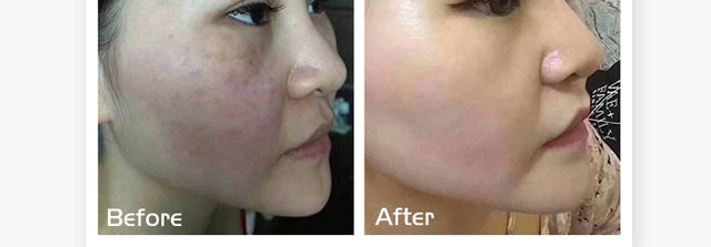 ΢�ķ����oԭҺ