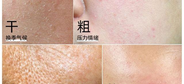 ��ȟo(w��)Ͼ���˪